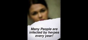 Herpes inflect